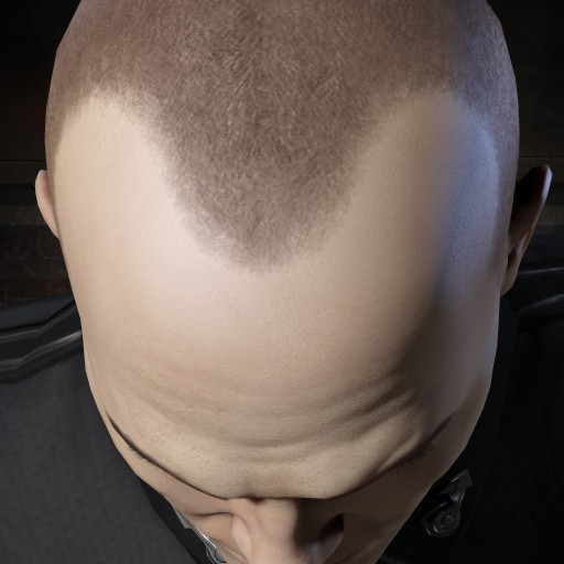 Balding