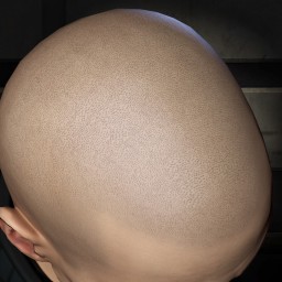 179315 portrait