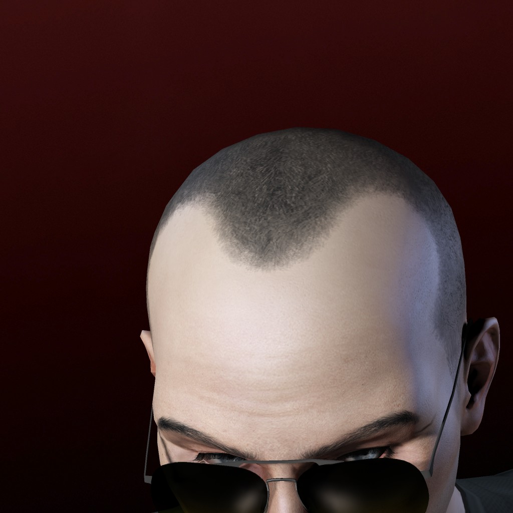 H Krankton