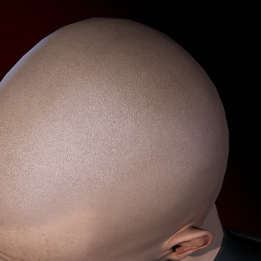 Fontanelle Man