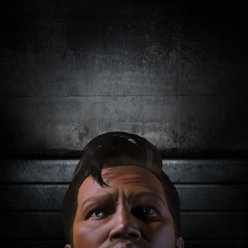 DownerSyndrom